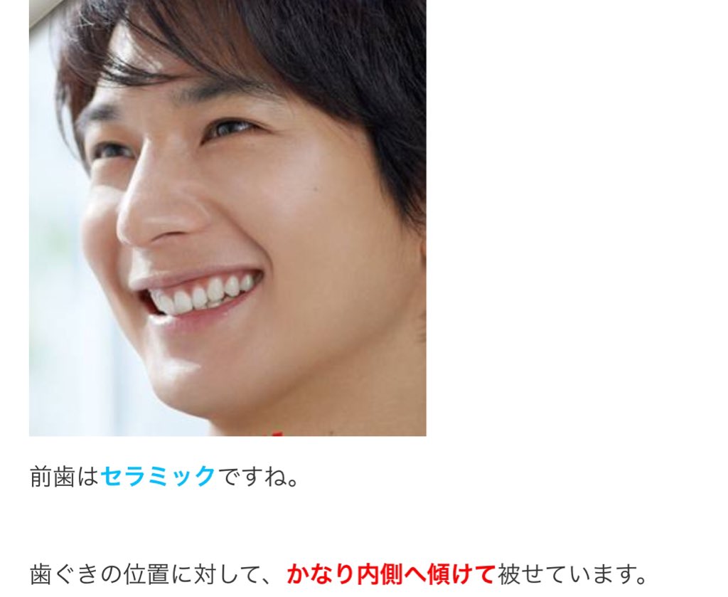 𓂃 室長さん 小動物系の可愛い人の歯並びは内向き前歯 この歯並びの顔 の特徴 上顎が発達して下顎より出る 下顎があまり成長してない 上顎が前方に出て顎が小さいから童顔で若く見える 石原さとみも宇垣アナもそうだよね 歯科的におすすめしないけど