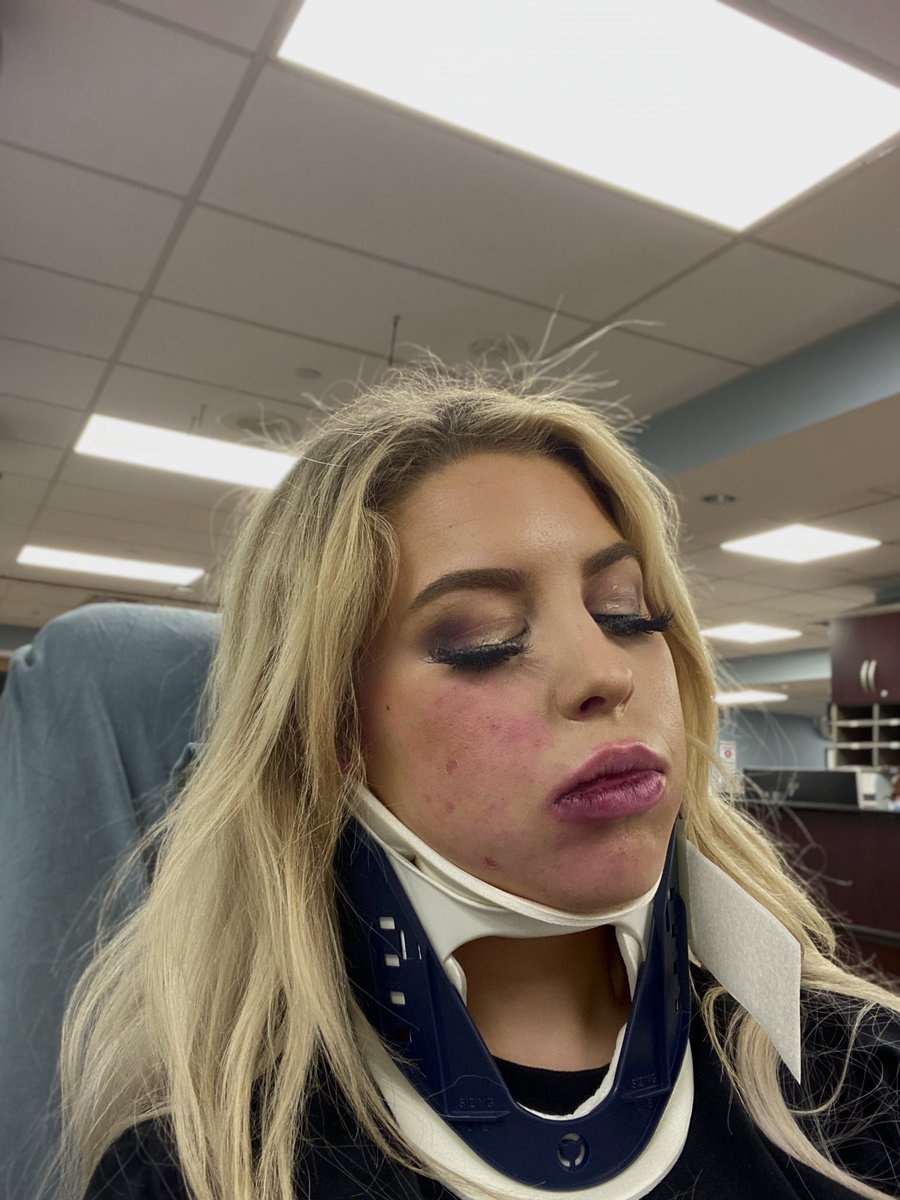 The aftermath of supporting @realDonaldTrump at the Women’s March today! https://t.co/p6goOyBjps