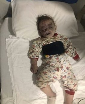 #ermeniakillscivilians " Hepimiz ermeniyiz " diyen yavşak sürüsü neredesiniz ?