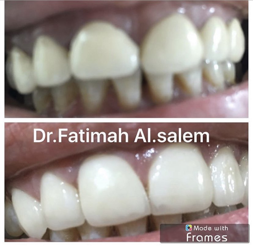 Dr. Fatimah AlSalem tweet media