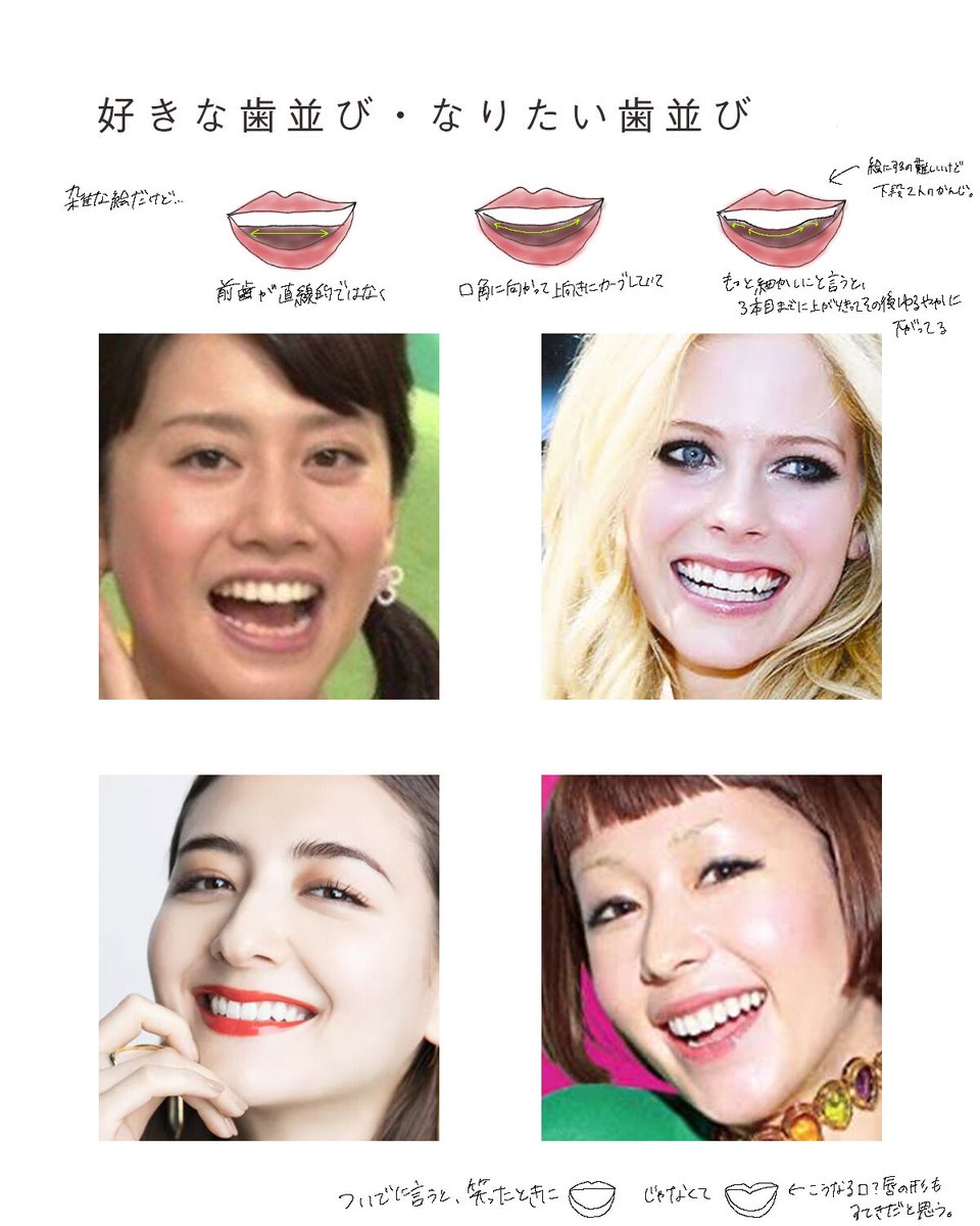 K子 これから矯正のカウンセリングをするにあたって 歯並びの画像集めてるのでまとめてみました 好きな歯並びの共通点は上の 歯のカーブ 矯正によってどこまで変えられるのか 自分の歯並びと骨格にポテンシャルがあるのかしっかり聞いてこようと思い