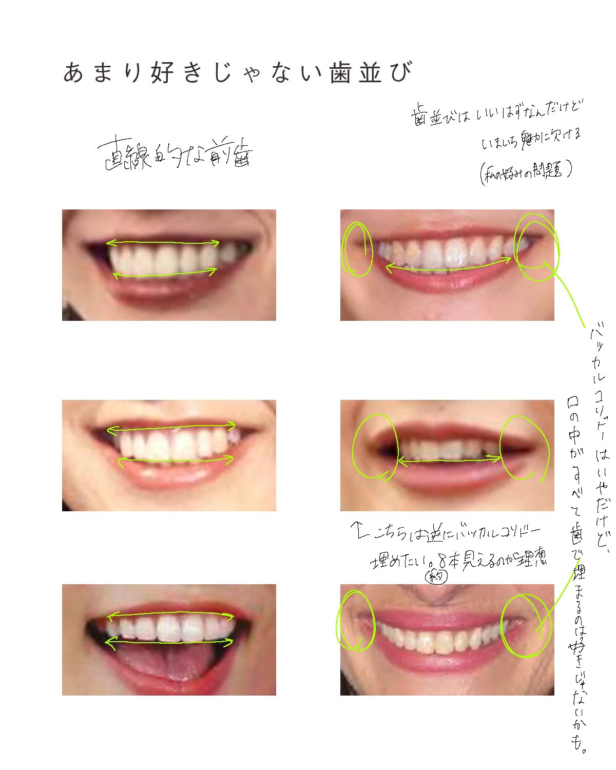 K子 番外編 メロディ洋子 前歯が大きめでかなり個性的な歯並び 彼女の整ったお顔の上ではチャーミングな個性として光るよね そして妙に色っぽい 整った顔とのバランスの結果 彼女は美しく見えるけど 決して凡人には真似できないよね
