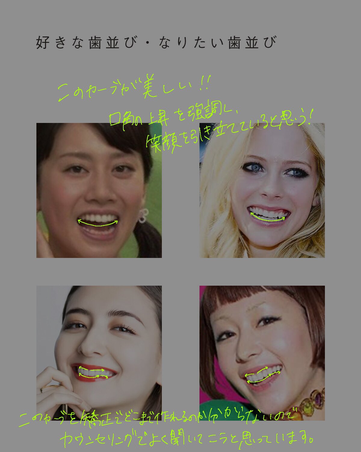 K子 これから矯正のカウンセリングをするにあたって 歯並びの画像集めてるのでまとめてみました 好きな歯並びの共通点は上の歯のカーブ 矯正によってどこまで変えられるのか 自分の歯並びと骨格にポテンシャルがあるのかしっかり