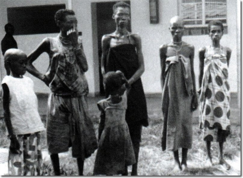 t7/ c1960s-Some of the starving Lumpas at Chinsali hospital.