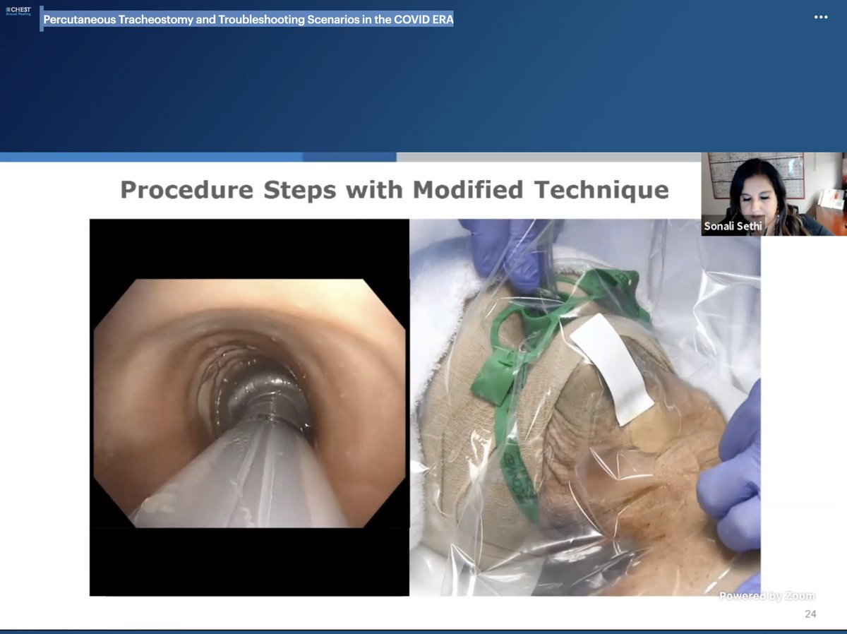 ahalraiyes's tweet photo. #CHEST2020 Percutaneous #Tracheostomy and Troubleshooting Scenarios in the #COVID19 ERA @accpchest #CHESTIPteam PDT modified technique during viral pandemic @carlala57791784 @uniquesona https://t.co/970wlvvMGh