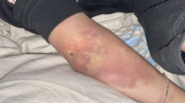 this shit so fucking painful