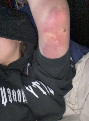 this shit so fucking painful