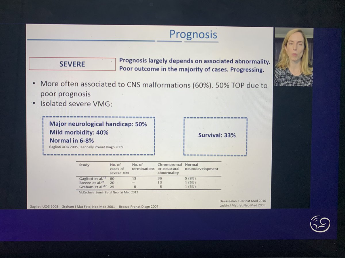 Outstanding presentation from <a href="/masancor07/">Magda Sanz</a> regarding ventriculomegaly. Thank you for such amazing masterclass! <a href="/ISUOG/">ISUOG</a> #isuog2020 #fetalmedicine #ventriculomegaly