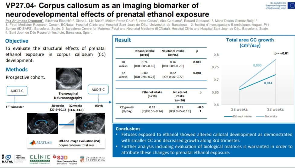 Paz_A_D's tweet photo. Excited for my 1st contributions at  @ISUOG. In my research I see  how susceptible the fetal 🧠 could be. 
Thanks for the incredible support &amp; inspiration! @elisendaeixarch @lgomezroig @dianalipbcn @medfetalBCN @BCNatalResearch
Let's go for more!  #passion 🌟 #LoveUltrasound ❤️ https://t.co/180Jfenjq7