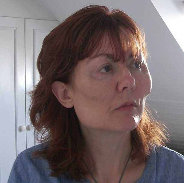 PotatoesMashedC's tweet image. I&apos;m going to @kirstiealley for my plastic surgery because she is NOT a surgeon. I went to her 4 years ago for my cheek implants and I&apos;m going to her again for my nose job in November.