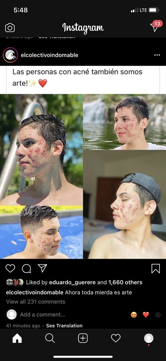 Ae No Se Q Pensar