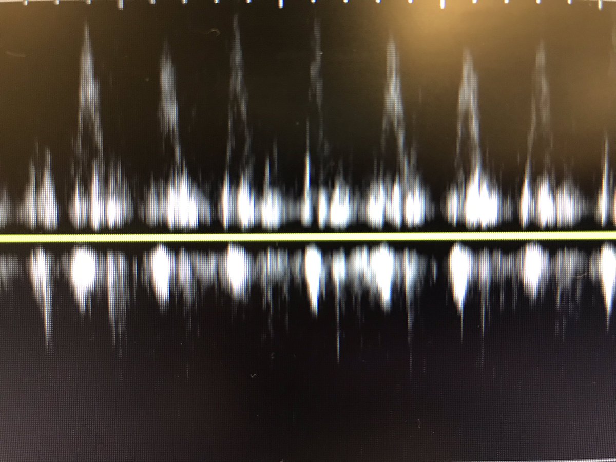 Anita Chary, MD PhD tweet media