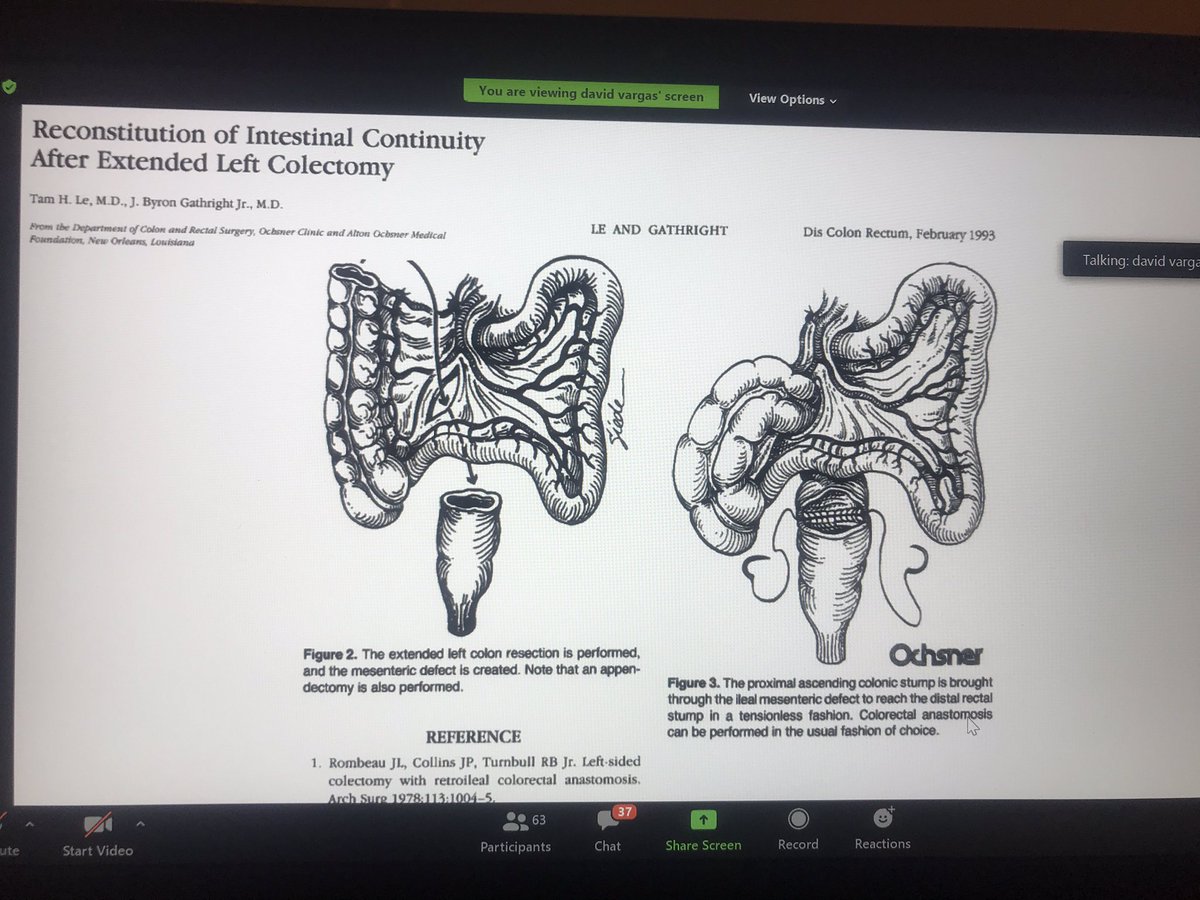 valevilchezp's tweet photo. Fantastic tips on advanced mobilization techniques for CRA by Dr. Vargas #CRVirtualED @jabelsonmd @TessAulet @KristenBanMD @slsteinmd1 https://t.co/SqRgUZKy52