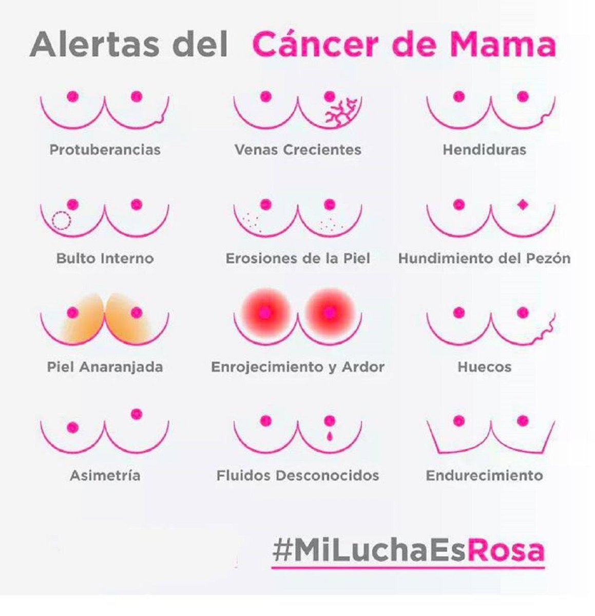 eva_hache's tweet photo. ¡¡TÓCATE LAS TETAS!! #tetas #19Octubre #UBRE #SacaPecho https://t.co/jYm8AIE9OT