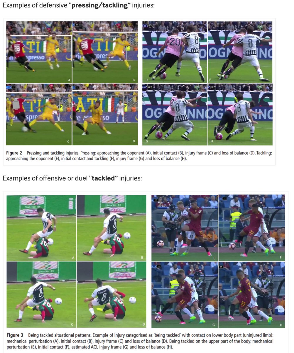 Steffan Griffin (@steffangriffin) on Twitter photo Football ACL injuries reloaded: how, where, and when. Thanks <a href="/FDellaVilla/">Francesco Della Villa MD</a> for this superb blog, as part of the <a href="/BJSM_BMJ/">British Journal of Sports Medicine (BJSM)</a> #KnowledgeTranslation series
For anyone interested in footballing ACL injuries (timely at present!) and how they might be prevented
blogs.bmj.com/bjsm/2020/10/1… Football ACL injuries reloaded: how, where, and when. Thanks <a href="/FDellaVilla/">Francesco Della Villa MD</a> for this superb blog, as part of the <a href="/BJSM_BMJ/">British Journal of Sports Medicine (BJSM)</a> #KnowledgeTranslation series
For anyone interested in footballing ACL injuries (timely at present!) and how they might be prevented
blogs.bmj.com/bjsm/2020/10/1…