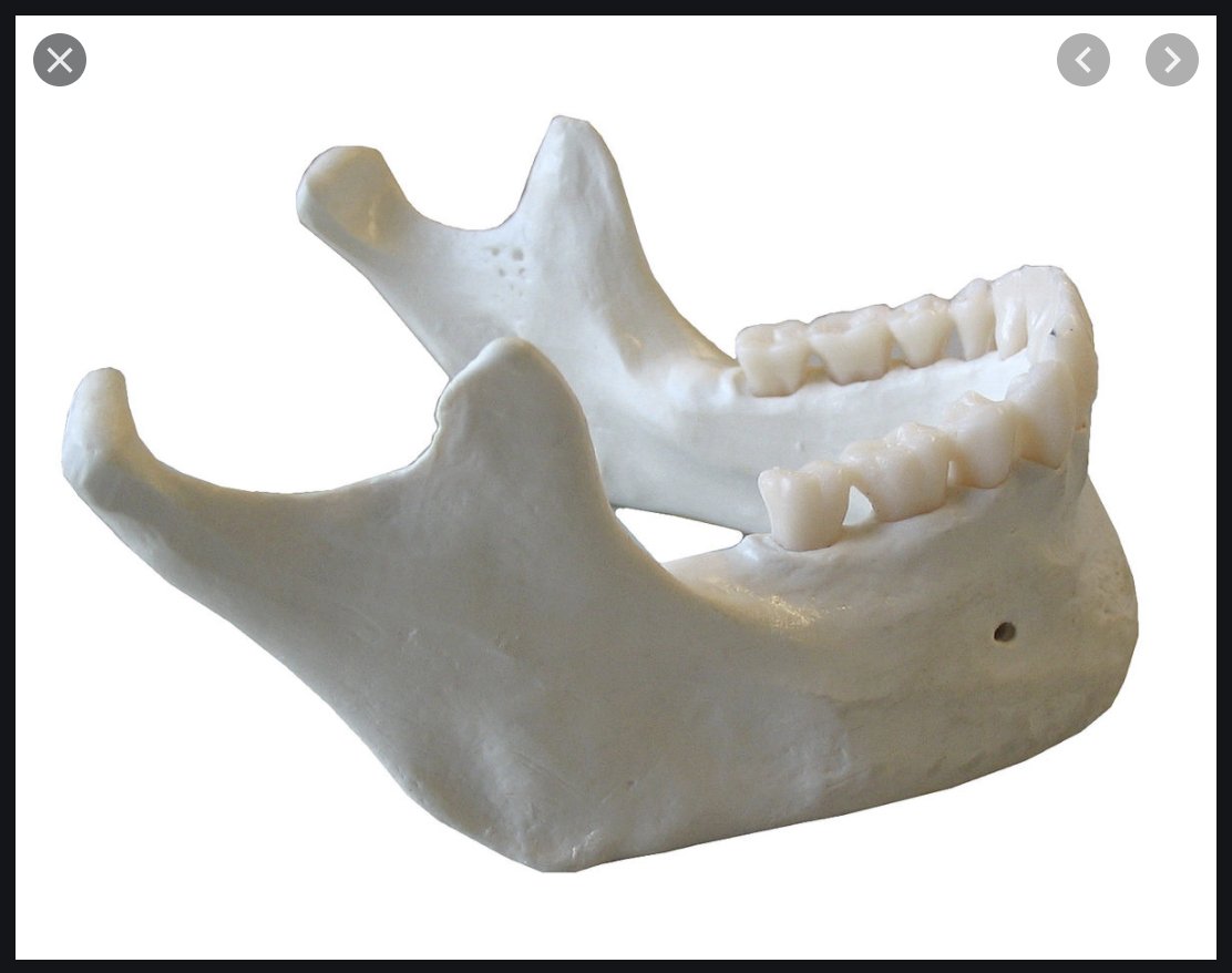 It's the only joint that I know of which has two sides to it unless you consider the whole pelvis to be a joint. Joints and muscles go together like wine and cheese so this is an important distinction when considering the jaw and its powerful muscles.