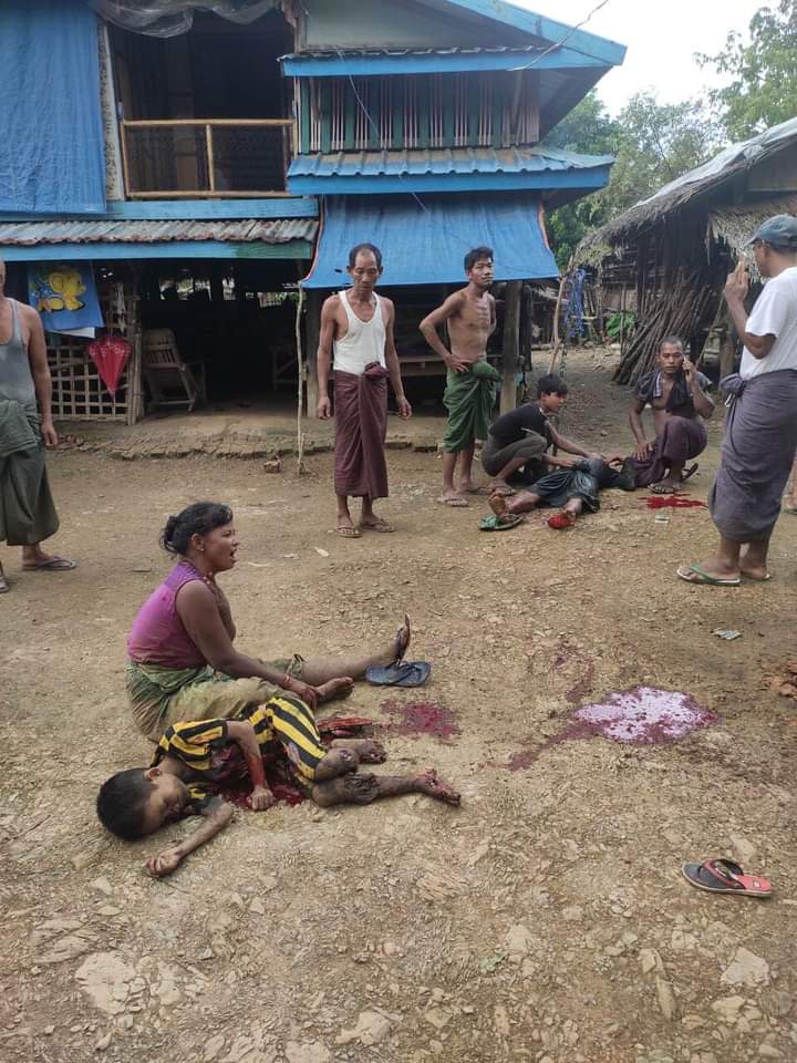 A child was killed by a Burmese army artillery shell in Mrauk-U Thammaraj ward The life of the land in the pool of blood
This is no Photo Shot,Happened in Rakhine 🙏