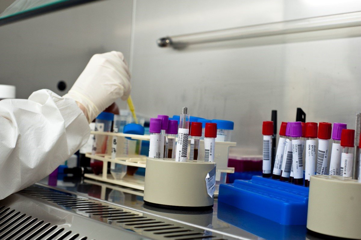 Le diabète de type 2 est un facteur de risque de développer une forme grave de #Covid19. Identifier les marqueurs immunitaires et inflammatoires associés à ces formes sévères permet une prise en charge plus adaptée et plus précoce

➡️bit.ly/2FK2Zvu