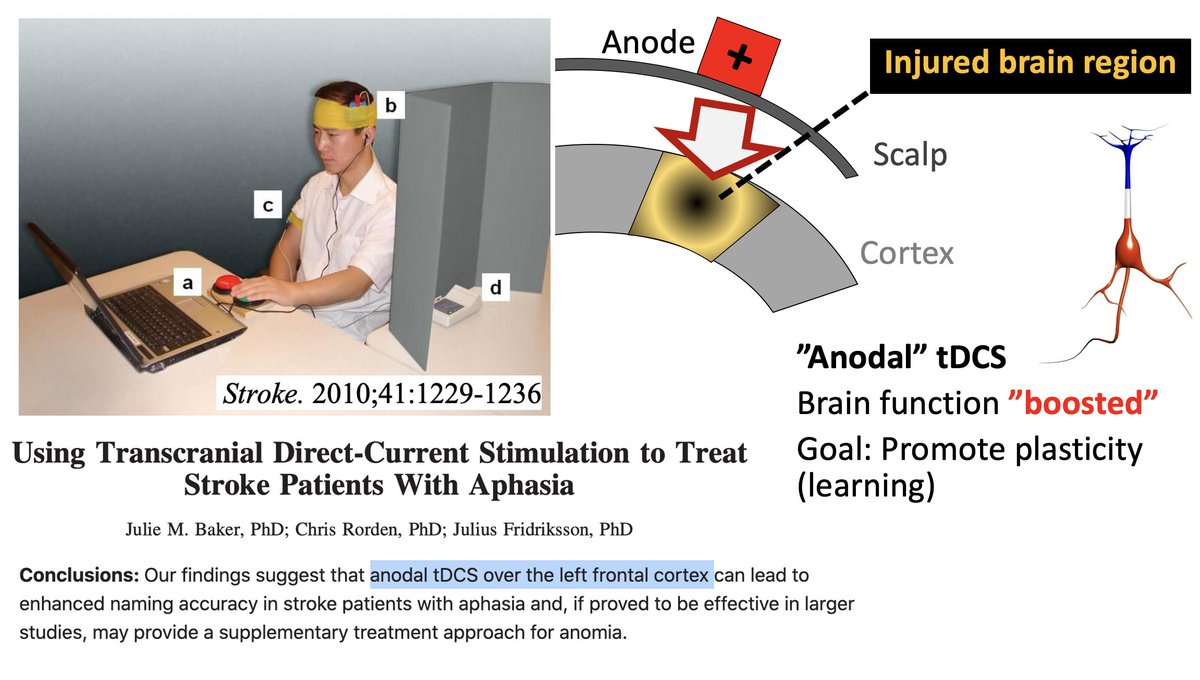 MaromBikson's tweet photo. Slides from my upcoming 2020 Academy of Aphasia #AoA2020 NIH keynote: transcranial Direct Current Stimulation (tDCS) boosts capacity for plasticity: https://t.co/H0gRKXfkBy
All publications here: https://t.co/2ULNFYAG6H https://t.co/Igq2mWrwxf