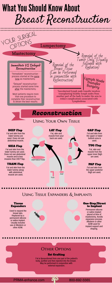 DiepFlapBreast's tweet photo. #DYK less than 25% of women know the wide range of #BreastReconstruction options available? Help us change that statistic by sharing this infographic!
Learn more about these procedures at https://t.co/0Jox98TG15
#RebuildingLives after #BreastCancer
#PlasticSurgery #bcsm #BCPEA https://t.co/INgybYdLuT