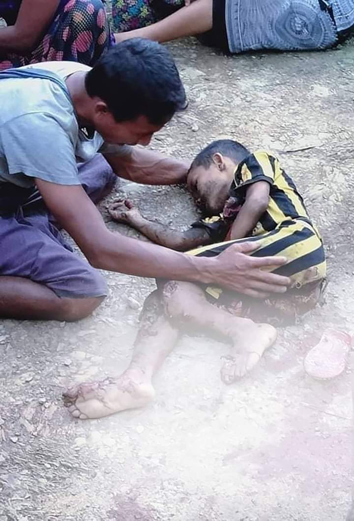 RSawyedullah's tweet photo. Breaking news 

A 6-year-old boy was killed and a man and a woman were injured when a heavy artillery shell exploded in the northern town of Mrauk-U in Rakhine by myanmar military @saadhammadi
@john_hq3 @FortifyRights @haque_shahidul @hrw @ICC @CIJ_ICJ
#Copied https://t.co/z4rStqdqjg