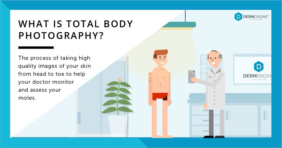 MoleScope's tweet image. Have you ever heard of total body photography? bit.ly/3dCJvW8
Click to learn more about how it can support your #skin health journey!
#dermatology #skincancerawareness #molescope