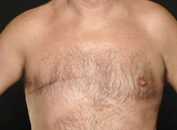 almagoch's tweet photo. El principal factor de riesgo para padecer #CancerDeMama es ser 🚺, podría parecer una obviedad, pero los 🚹s también pueden padecerlo. Es raro, y representan < 1% de los casos, pero sucede. #DiaMundialCancerMama https://t.co/f4kz2GXtHc