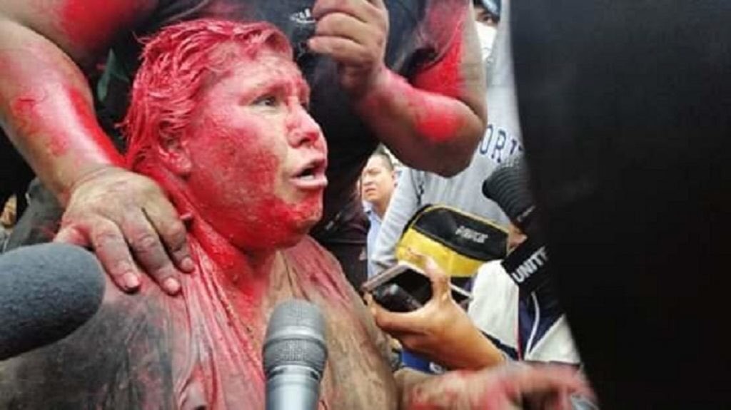 puellaok's tweet photo. ¿Se acuerda de Patricia Arce, ex alcaldesa de Vinto, en Cochabamba? Hace un año un comando golpista la rociaba con pintura roja, le cortaba el pelo y la obligaba a caminar descalza. Hoy es senadora electa por el MAS. El pueblo boliviano puso las cosas en su lugar. https://t.co/bsggOpZWYa