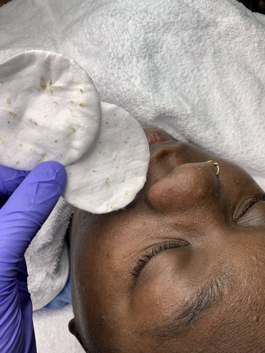 RoyalEstheticz's tweet photo. We have added facial services to our roster!
Our owner is a licensed esthetician 🧖🏾‍♀️ 
Book your facial treatment Today!
#SouthernNotState #Facial #Statesboro https://t.co/JFTqf3gfEs