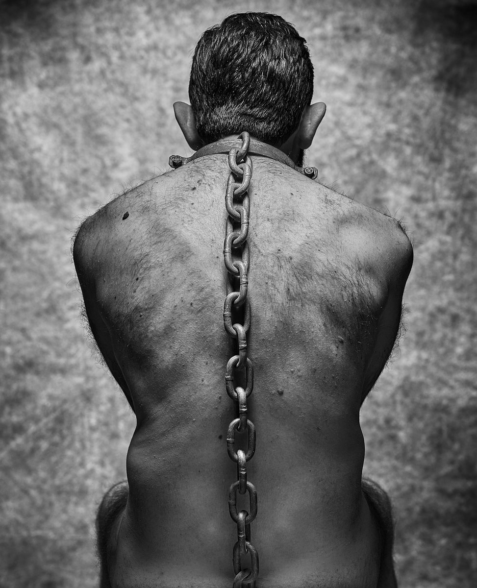 Hoy 20 de Octubre es el día nacional de la espondilitis anquilosante en España. Estos días no son para celebrar sino para visibilizar y concienciar a quien no conoce la patología y sus consecuencias.
👇🏽