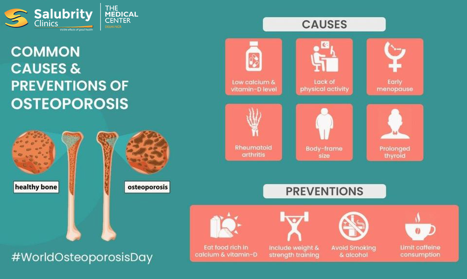 #Osteoporosis makes bones weak, fragile, and prone to breakage. On this World Osteoporosis Day, let us spread awareness about the causes and prevention to reduce the risk of osteoporosis.
#SalubrityClinics #worldosteoporosisday #causes #prevention #healthcare #health https://t.co/qdlzBcQg1k