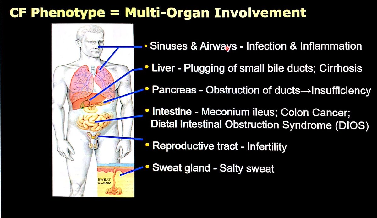 CF is a multisystem disease!  #CHEST2020