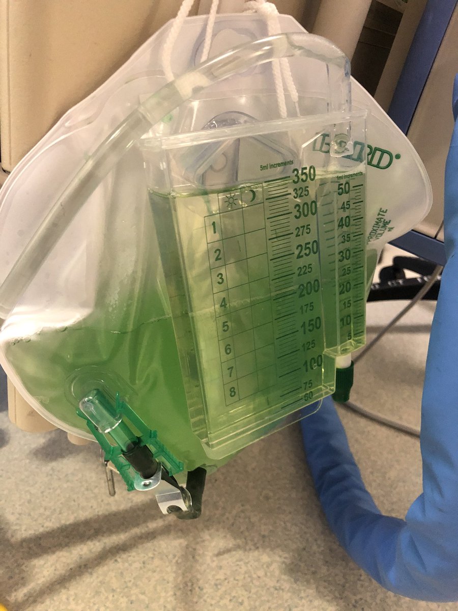 What is on your ddx for green urine?

Wonder if @CPSolvers has a schema for this one! 

#MedTwitter #NephTwitter #ToxTwitter #MedEd