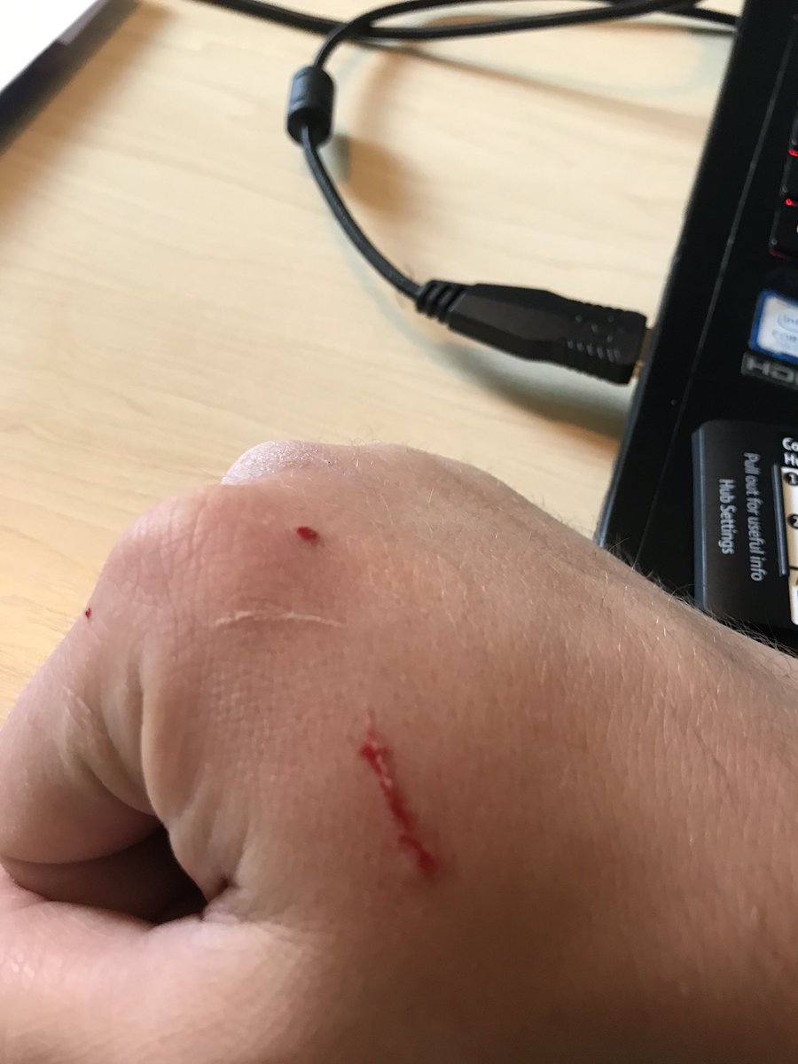 Rare trip to the office today. Been attacked by the cat who was initially pleased to see me until I forgot the angle of approach etiquette, while the other office familiar has been sitting and staring at me for the past 10 minutes.