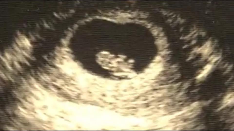 This is an ultrasound image of my firstborn son, Ben, taken 8 weeks into his mother’s pregnancy. This is the same head I kiss good night (though with much less red hair here). These are the same little hands I hold when we cross the street (though they are bigger now).