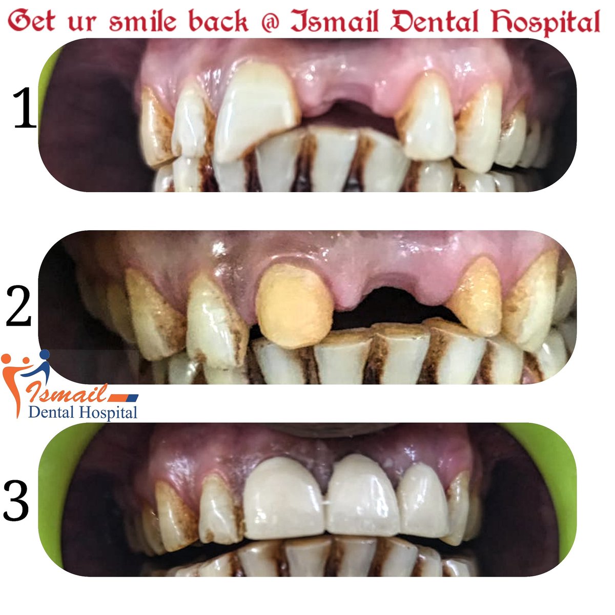 IsmailDentalHospital tweet media