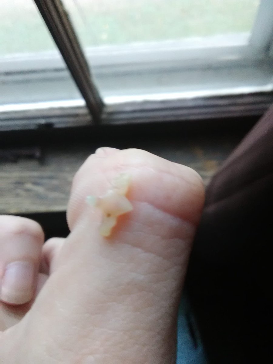 Catchawhisper's tweet photo. That's a kitten tooth. On my thumb. Yo. Toothless lost a tooth and spit it out. https://t.co/fKvyPilmj4. THUMB https://t.co/ulGKDeaiaW