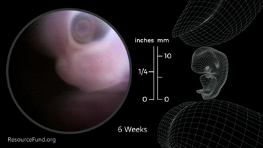 KY Right to Life Victory PAC tweet media