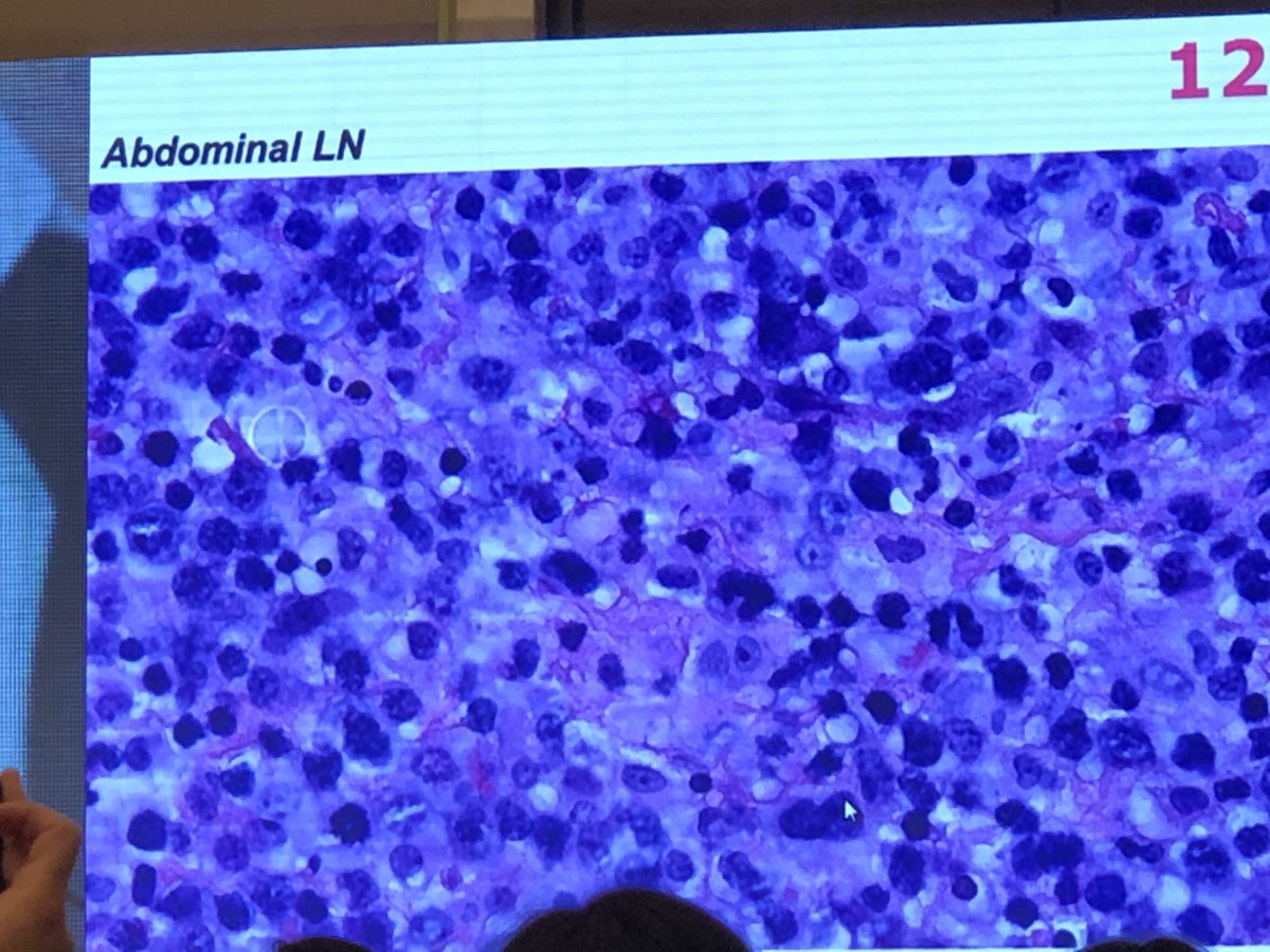 feldstej's tweet photo. #tuesdayviews #tuesdaythoughts #tuesdayvibes #tuesdaymood #tuesdaytb #cshp19tb #xian #tuesdayadventure #tuesdaymotivation #pathology #pathtwitterfamily https://t.co/tgKSqhEmGx
