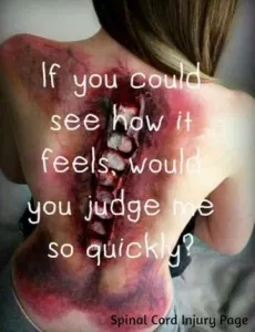 hannahsmiley's tweet image. I live with Transverse Myelitis
#InvisibleDisabilitiesWeek #SolveMECFS