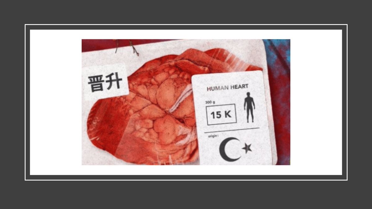 Prélèvements d'organes sur des Ouïghours encore vivant !!!