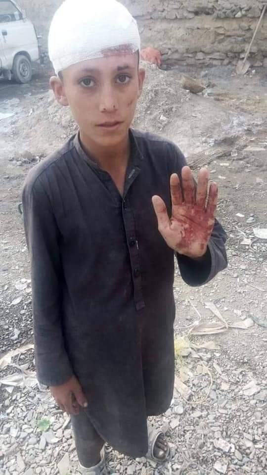 shabira80440002's tweet photo. یہ فلسطین کشمیرکے بچے نہیں یہ  وہ بچے ہیں جو صرف دو وقت روٹی کے لئے طورخم بارڈر پر محنت مزدوری کرتا ہے جو روزانہ ایف سی اہلکاروں کے ہاتھوں تشدد کا نشانہ بنتے ہیں https://t.co/U08kMd8TE6