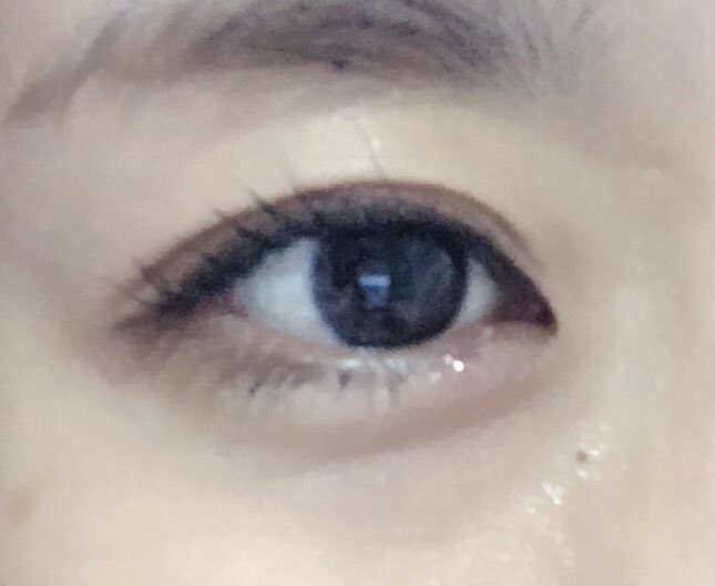 ট ইট র しゃけでっぱ 左目の下がものもらいで激痛 でも見た目は涙袋みたいで気に入った笑笑 涙袋が全く無いので ヒアルロン酸入れたくなったー