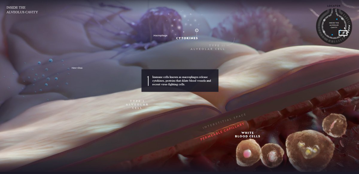 Fernando de la Guía (@cardio_delaguia) on Twitter photo Fantásticas imágenes de <a href="/NatGeo_la/">National Geographic LATAM</a>
Cómo el coronavirus se infiltra en el cuerpo y cómo el sistema inmunológico puede reaccionar de forma exagerada, con consecuencias mortales.
nationalgeographic.com/magazine/2020/… Fantásticas imágenes de <a href="/NatGeo_la/">National Geographic LATAM</a>
Cómo el coronavirus se infiltra en el cuerpo y cómo el sistema inmunológico puede reaccionar de forma exagerada, con consecuencias mortales.
nationalgeographic.com/magazine/2020/…