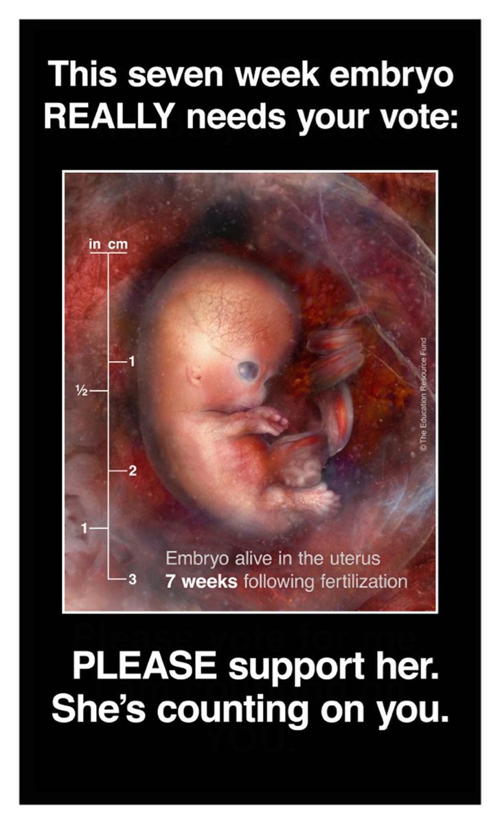 ProLifeAction's tweet photo. #ElectionDay is TOMORROW! Remember this 7-week embryo when you cast your vote. https://t.co/zFPSukxiyI