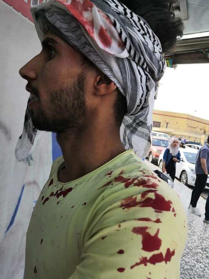 ameer12mohammed's tweet photo. عندما اعتدى الكاظمي @MAKadhimi ووزير الصحة @TemimiHassan من الخريجين المجموعه الطبيه اليوم قد بين قضية احترام الشهادة العراقية قد ولى وان المنظومة التعليمية قلد افشلناها ولا حياة محترمة لكم بالعراق بعد اليوم نحن جئنا لنكمل الخراب الذي بدأتها الحكومات التي سبقتنا #خريجي_الصحه_تقمع https://t.co/uWzdwf3r7R