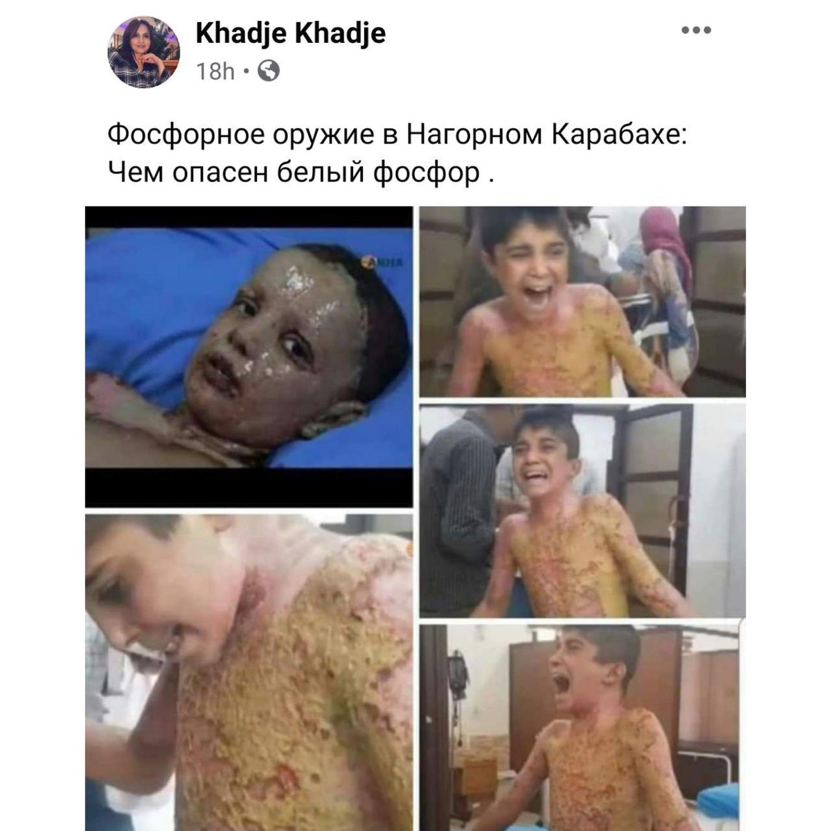 malikoshi's tweet photo. ANOTHER ARMENIAN LİE❗#Armenia|ns present the events in Syria in 2019 as if they took place in #Karabakh.The #Azerbaijan|i army does not use phosphorus weapons in combat. In general, these weapons are not in the arsenal of our #army.
#ArmenianLies #DontBeBlind #DontBelieveArmenia https://t.co/rLfC3OiQdh