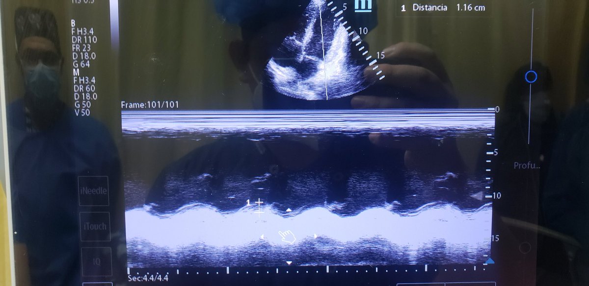 EmRad8's tweet image. mejorando