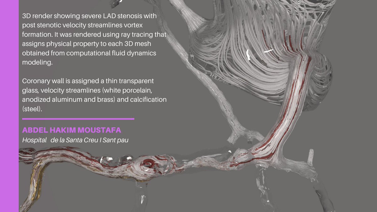 Journal of Cardiovascular CT tweet media
