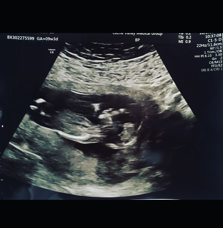 iggadvisors's tweet photo. Surprise! A new Iron Gate family member is on its way!  Congratulations McKenna!! #iggafamily #april28 https://t.co/AOKqs5YgPG